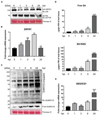 Global SUMOylome Adjustments in Basal Defenses of Arabidopsis thaliana Involve Complex Interplay Between SMALL-UBIQUITIN LIKE MODIFIERs and the Negative Immune Regulator SUPPRESSOR OF rps4-RLD1